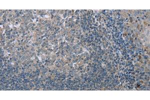 Immunohistochemistry of paraffin-embedded Human tonsil tissue using FAR2 Polyclonal Antibody at dilution 1:40 (FAR2 antibody)