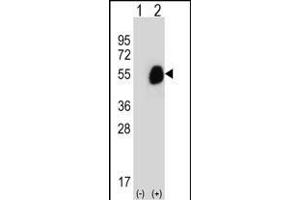 Western blot analysis of GCDH (arrow) using rabbit polyclonal GCDH Antibody (C-term) (ABIN656829 and ABIN2846038). (GCDH antibody  (C-Term))