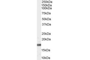 Western Blotting (WB) image for anti-Cell Division Cycle 27 Homolog (S. Cerevisiae) (CDC27) (C-Term) antibody (ABIN2156576) (CDC27 antibody  (C-Term))