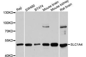 Western blot analysis of extracts of various cells, using SLC1A4 antibody.