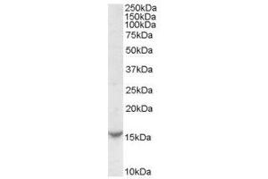 Image no. 1 for anti-T-Cell Leukemia/lymphoma 1A (TCL1A) (Internal Region) antibody (ABIN374885)
