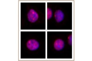 MLL / HRX antibody (pAb) tested by Immunofluorescence. (MLL/KMT2A antibody  (AA 2829-2883))