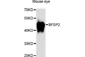 Western blot analysis of extracts of mouse eye, using BFSP2 antibody (ABIN6290111) at 1:3000 dilution.