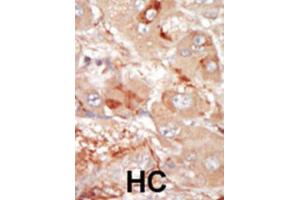 Immunohistochemistry (IHC) image for anti-Serine/threonine-Protein Kinase PRP4 Homolog (PRPF4B) antibody (ABIN3003283) (PRPF4B antibody)