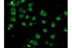 Image no. 3 for anti-Spastic Paraplegia 7 (SPG7) (AA 300-573) antibody (ABIN1491369) (SPG7 antibody  (AA 300-573))
