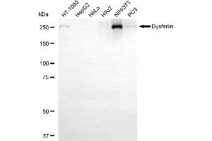 Western blotting analysis using Dysferlin antibody (ABIN7798406).