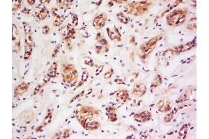 Formalin-fixed and paraffin embedded human kidney labeled with Anti-NOS-2/iNOS Polyclonal Antibody, Unconjugated  at 1:200 followed by conjugation to the secondary antibody and DAB staining.