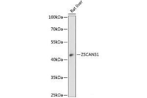 Western blot analysis of extracts of Rat liver using ZSCAN31 Polyclonal Antibody at dilution of 1:3000. (ZKSCAN2 antibody)