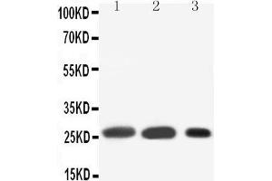 Anti-SFTPA1 antibody, Western blotting Lane 1: Rat Lung Tissue Lysate Lane 2: Rat Lung Tissue Lysate Lane 3: MK(55KD) (Surfactant Protein A1 antibody  (C-Term))
