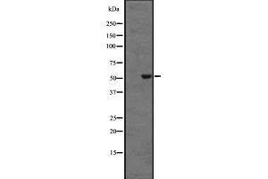 Western blot analysis of DRD5 expression in HEK293 cells ,The lane on the left is treated with the antigen-specific peptide. (DRD5 antibody  (N-Term))
