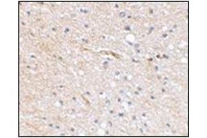 Immunohistochemical staining of human brain tissue using AP30769PU-N at 2. (FBXL20 antibody  (N-Term))