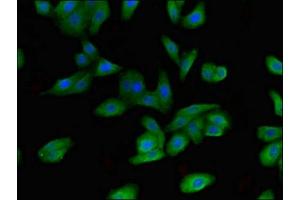 Immunofluorescent analysis of HepG2 cells using ABIN7152451 at dilution of 1:100 and Alexa Fluor 488-congugated AffiniPure Goat Anti-Rabbit IgG(H+L) (FBXO9 antibody  (AA 13-111))
