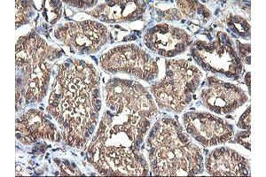 Immunohistochemical staining of paraffin-embedded Human Kidney tissue using anti-TUBAL3 mouse monoclonal antibody.