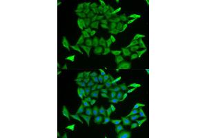 Immunofluorescence (IF) image for anti-MB antibody (ABIN1876659) (MB antibody)