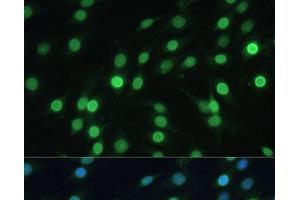 Immunofluorescence analysis of C6 cells using LBR Polyclonal Antibody at dilution of 1:100 (40x lens). (Lamin B Receptor antibody)
