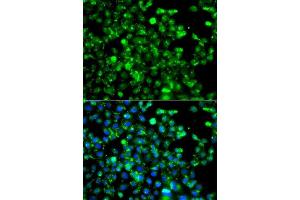 Immunofluorescence analysis of A549 cells using CAPN5 antibody. (Calpain 5 antibody  (AA 361-640))
