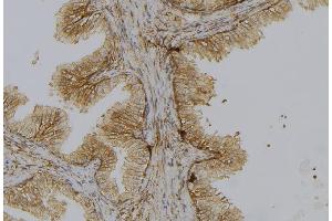 ABIN6278443 at 1/100 staining Mouse colon tissue by IHC-P. (CTP Synthase antibody  (C-Term))