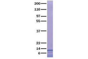 Validation with Western Blot (CCL27 Protein (Transcript Variant 2))