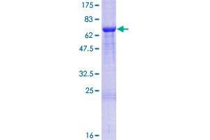 Image no. 1 for Chromosome 21 Open Reading Frame 2 (C21orf2) (AA 1-375) protein (GST tag) (ABIN1347440) (C21orf2 Protein (AA 1-375) (GST tag))