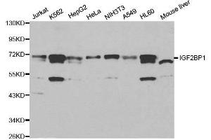 Western blot analysis of extracts of various cell lines, using IGF2BP1 antibody. (IGF2BP1 antibody  (C-Term))