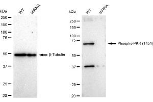 Western blotting analysis using Phospho-PKR (T451) antibody (ABIN7798509). (Recombinant EIF2AK2 antibody  (pThr451))