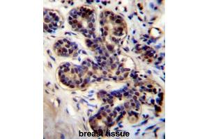 PROX2 Antibody (C-term) immunohistochemistry analysis in formalin fixed and paraffin embedded human breast tissue followed by peroxidase conjugation of the secondary antibody and DAB staining. (PROX2 antibody  (C-Term))