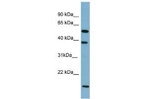 SLC10A1 antibody used at 1 ug/ml to detect target protein. (SLC10A1 antibody)