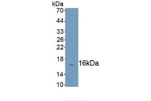 Detection of Recombinant CFHR3, Human using Polyclonal Antibody to Complement Factor H Related Protein 3 (CFHR3) (CFHR3 antibody  (AA 208-330))