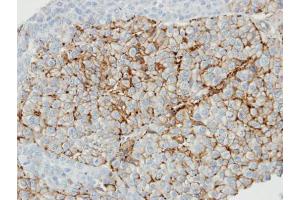 Immunohistochemistry (IHC) image for anti-Caveolin 1, Caveolae Protein, 22kDa (CAV1) (N-Term) antibody (ABIN2854651)