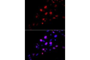 Immunofluorescence analysis of U2OS cell using RAD18 antibody. (RAD18 antibody)