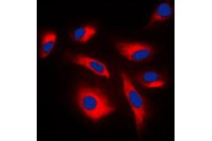 Immunofluorescent analysis of Caspase 6 p18 staining in NIH3T3 cells. (Caspase 6 p18 (Center) antibody)