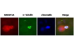 Image no. 2 for anti-Ras Association (RalGDS/AF-6) Domain Family Member 1 (RASSF1) antibody (ABIN165456) (RASSF1 antibody)
