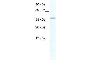 WB Suggested Anti-GATA5 Antibody Titration:  1. (GATA5 antibody  (C-Term))