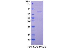 SDS-PAGE (SDS) image for Aquaporin 1 (Colton Blood Group) (AQP1) (AA 201-269) protein (His tag,GST tag) (ABIN2122451)