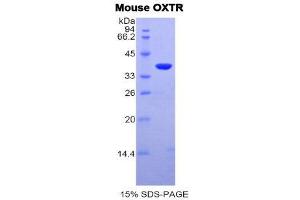 SDS-PAGE (SDS) image for Oxytocin Receptor (OXTR) (AA 6-75) protein (His tag,GST tag) (ABIN2123436)
