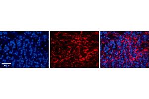 Rabbit Anti-LAPTM4B Antibody     Formalin Fixed Paraffin Embedded Tissue: Human Pineal Tissue  Observed Staining: Membrane and cytoplasmic in processes of pinealocytes and intersticial cells  Primary Antibody Concentration: 1:100  Other Working Concentrations: 1/600  Secondary Antibody: Donkey anti-Rabbit-Cy3  Secondary Antibody Concentration: 1:200  Magnification: 20X  Exposure Time: 0. (LAPTM4B antibody  (Middle Region))