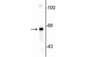 Western blot of rat cortex lysate showing specific immunolabeling of the ~ 66 kDa alpha internexin protein. (INA antibody)
