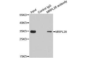 Immunoprecipitation analysis of 200 μg extracts of 293T cells using 1 μg MRPL28 antibody (ABIN5973497).