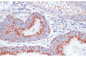 Immunohistochemistry (Paraffin-embedded Sections) (IHC (p)) image for anti-Transferrin Receptor (p90, CD71) (TFRC) antibody (ABIN7261824)