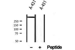 Western blot analysis of extracts from A431, using DST Antibody. (Dystonin antibody  (C-Term))