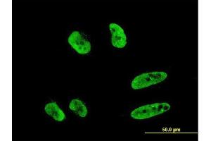 Immunofluorescence of monoclonal antibody to RNF151 on HeLa cell. (RNF151 antibody  (AA 68-173))