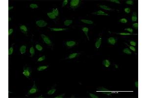 Immunofluorescence of monoclonal antibody to STC1 on HeLa cell. (Stanniocalcin 1 antibody  (AA 141-247))