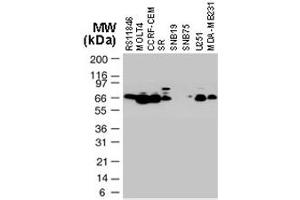 Western blot analysis of TRAF3 in various tumor cell lines.