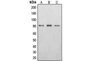 Western blot analysis of EPS8L2 expression in HepG2 (A), HeLa (B), A431 (C) whole cell lysates. (EPS8-Like 2 antibody  (N-Term))