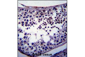 NANOG Antibody (ABIN387791 and ABIN2838027) immunohistochemistry analysis in formalin fixed and paraffin embedded human testis tissue followed by peroxidase conjμgation of the secondary antibody and DAB staining. (Nanog antibody)