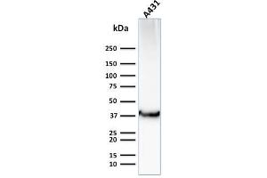 Western Blot Analysis of Human A431 cell lysate using GLUT-1 Mouse Monoclonal Antibody (GLUT1/2476). (GLUT1 antibody  (AA 203-305))