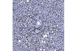 IHC analysis of SF3A1 using anti-SF3A1 antibody (ABIN7600556). (SF3A1 antibody  (AA 20-556))