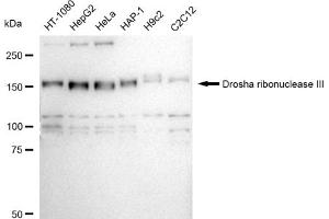 Western blotting analysis using Drosha ribonuclease III antibody (ABIN7798389).