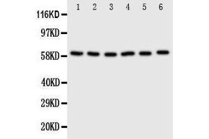 Anti-SCLY antibody, Western blotting Lane 1: U87 Cell Lysate Lane 2: HELA Cell Lysate Lane 3: 293T Cell Lysate Lane 4: MCF-7 Cell Lysate Lane 5: COLO320 Cell Lysate Lane 6:  Cell Lysate (SCLY antibody  (C-Term))