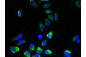 Immunofluorescent analysis of A549 cells using ABIN7173167 at dilution of 1:100 and Alexa Fluor 488-congugated AffiniPure Goat Anti-Rabbit IgG(H+L) (TMEM243 antibody  (AA 1-31))